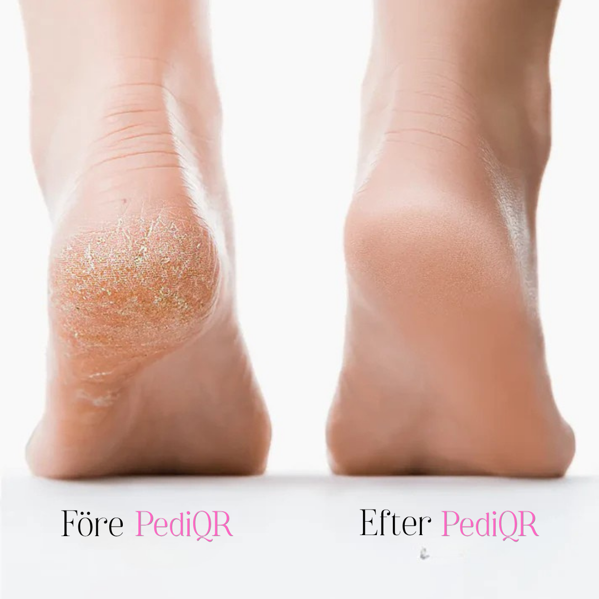 PediQR Pro — Professionell pedikyr utan salong.
